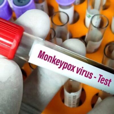 Sesab informa que Bahia tem 75 infectados com varíola dos macacos