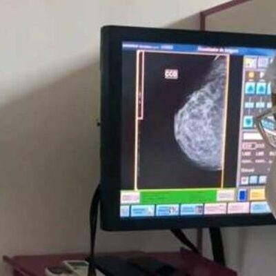 Outubro Rosa: mamografias realizadas no Caminhão de Rastreamento podem ser retiradas na Sesau