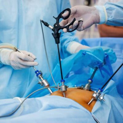 SAÚDE: Brasil discute novas regras para cirurgia bariátrica