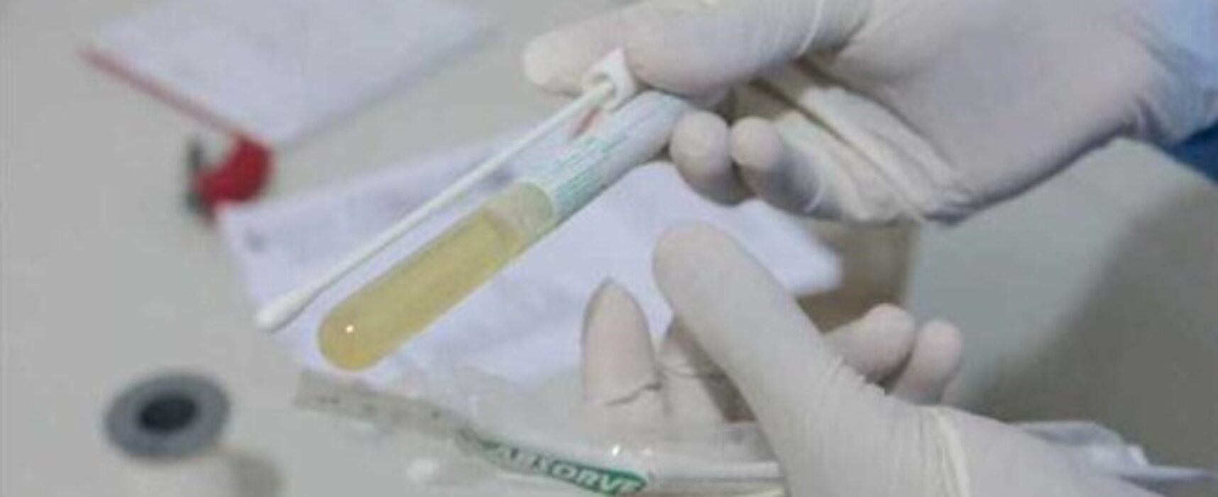 Covid-19: triagem é realizada na UPA da Esperança e no PA da Zona Sul