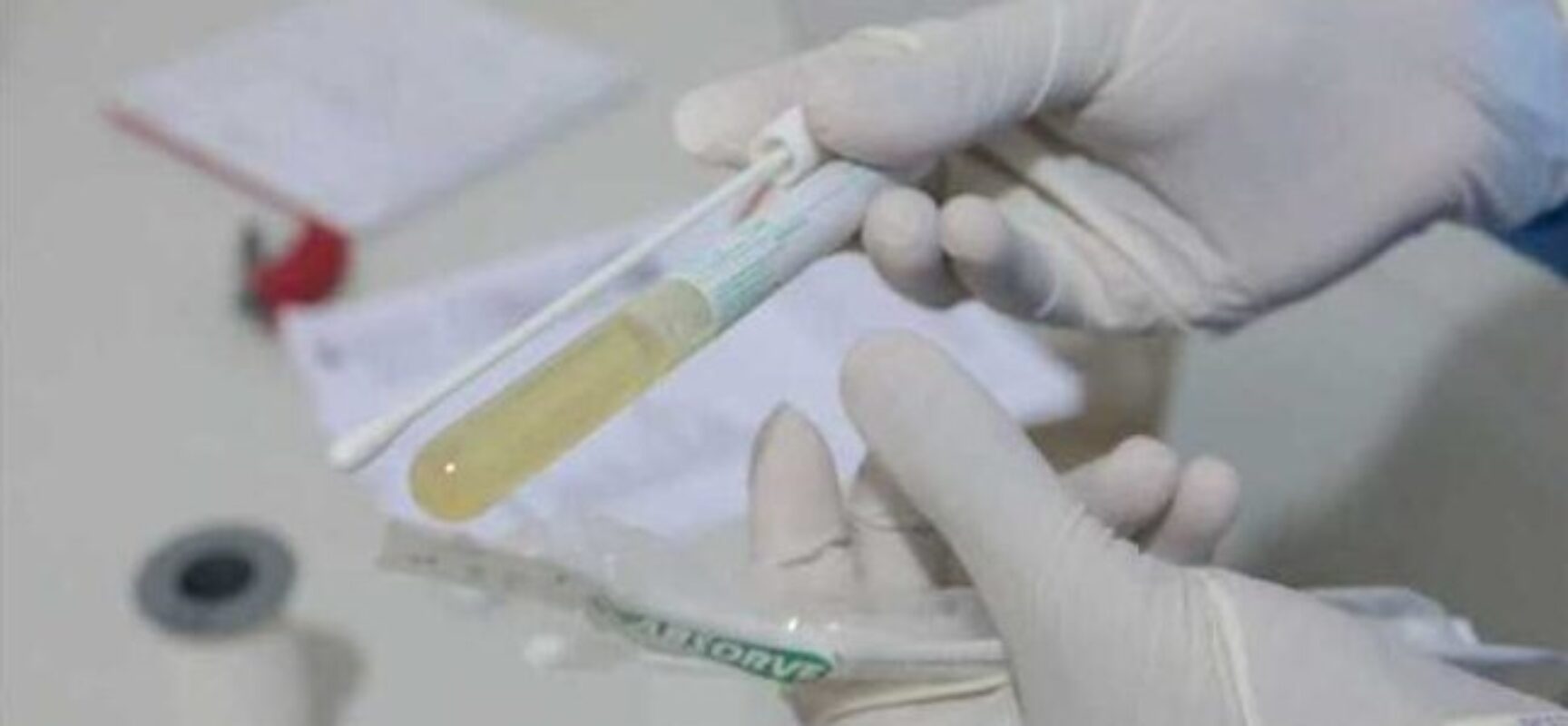 Covid-19: triagem é realizada na UPA da Esperança e no PA da Zona Sul