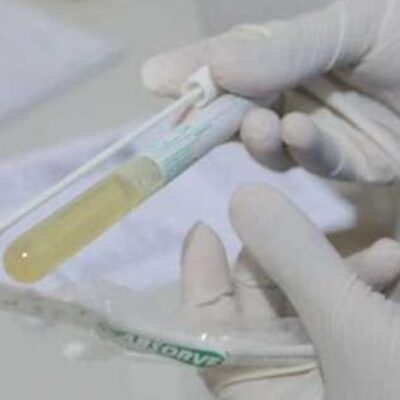 Covid-19: triagem é realizada na UPA da Esperança e no PA da Zona Sul