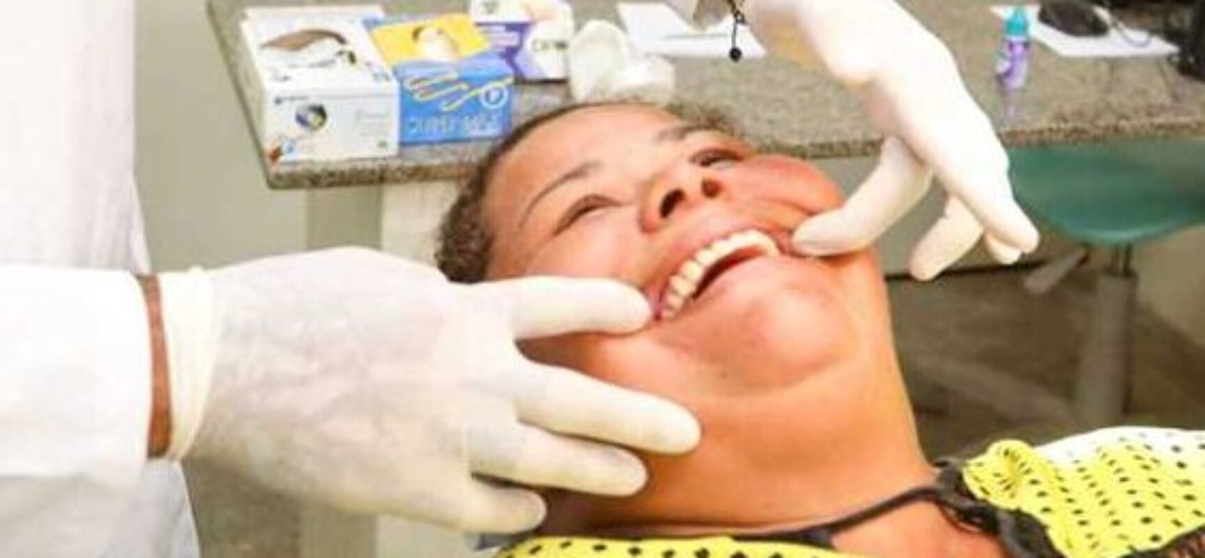 Prefeitura de Ilhéus retoma fornecimento de próteses dentárias no município
