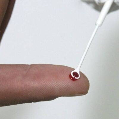PrEP: tratamento preventivo é alternativa no combate ao HIV no Brasil