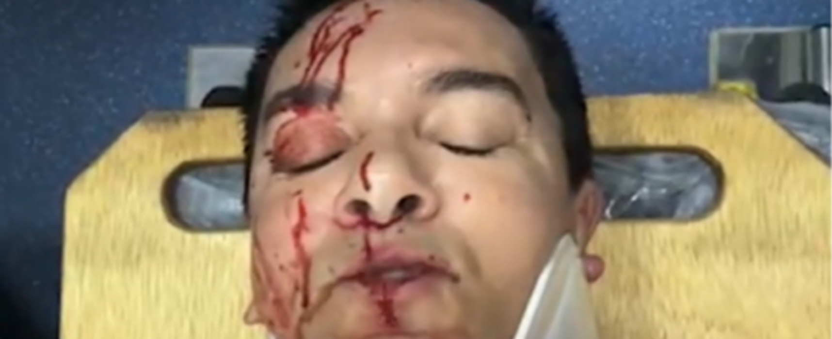 Cantor gospel Regis Danese sofre acidente de carro e pede orações