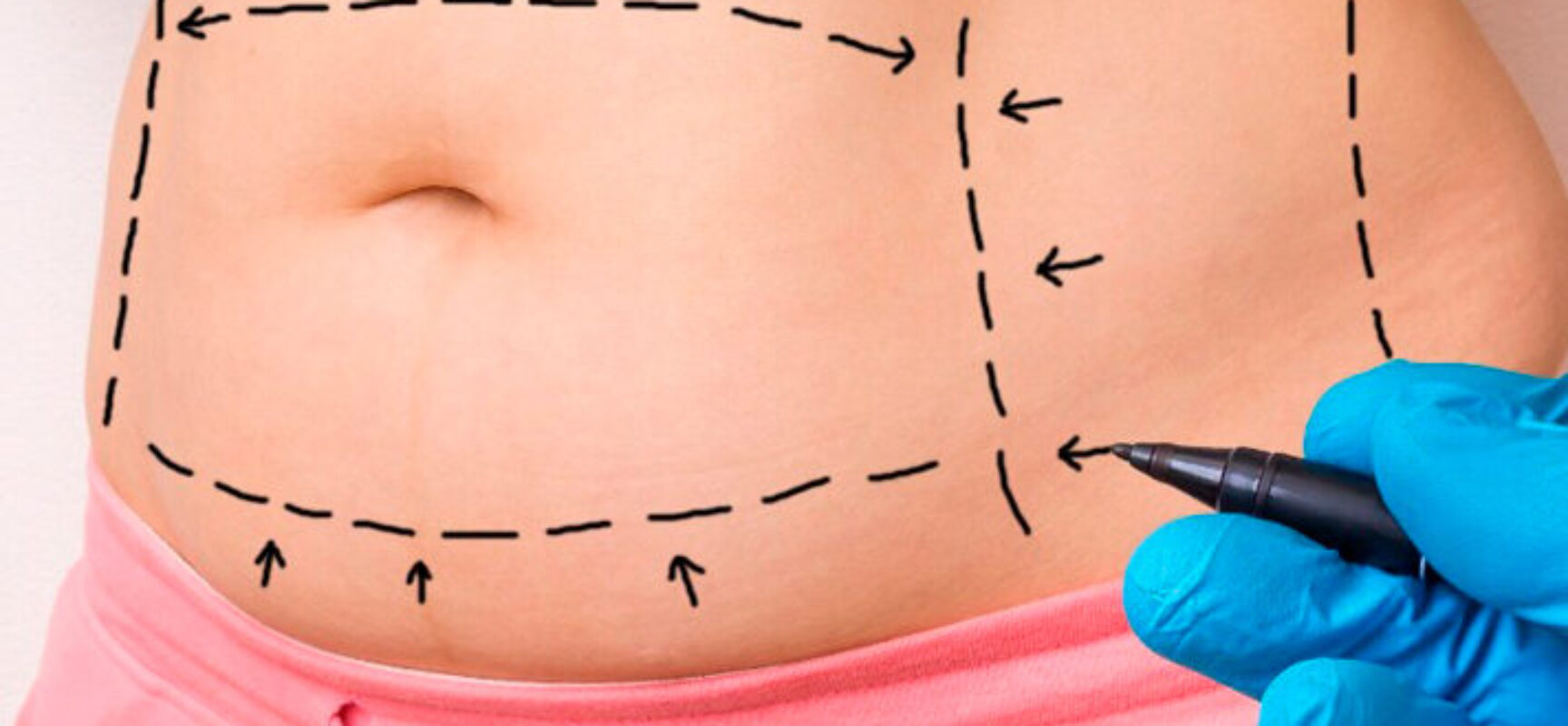 Proposição de Ederjunior que assegura às mulheres o direito de estarem acompanhadas, nas consultas e exames relacionados à sua saúde, agora é lei