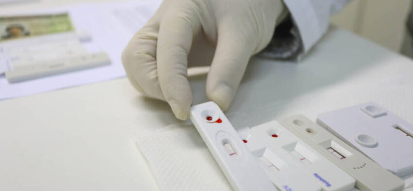 SUS incorpora teste para detecção de HPV em mulheres