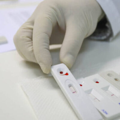 SUS incorpora teste para detecção de HPV em mulheres