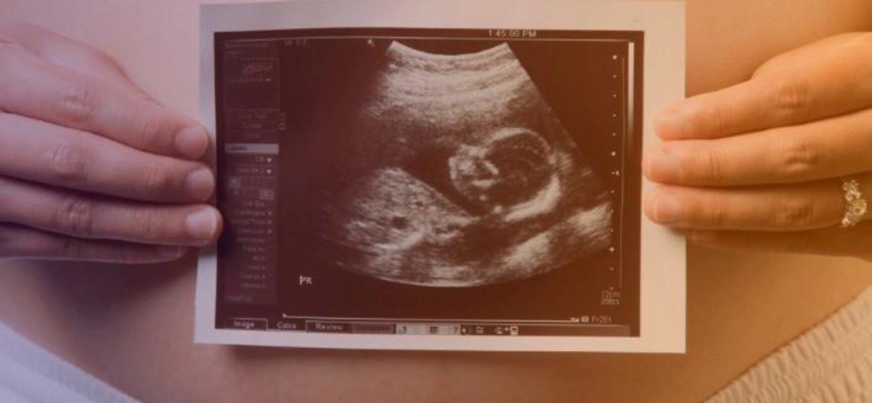 Governo Mário Alexandre fortaleceu o CMAE e intensificou o cuidado com gestantes de alto risco