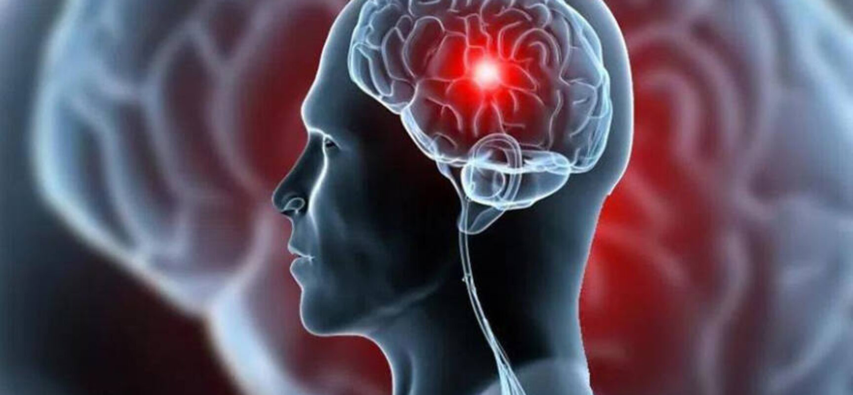 Ilhéus promove evento sobre prevenção e tratamento do AVC