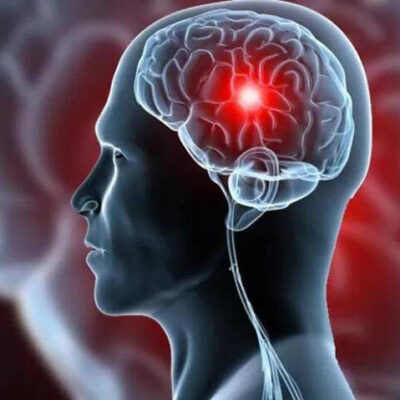 Ilhéus promove evento sobre prevenção e tratamento do AVC