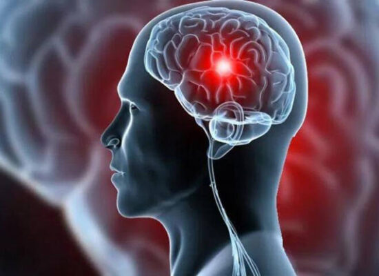 Ilhéus promove evento sobre prevenção e tratamento do AVC