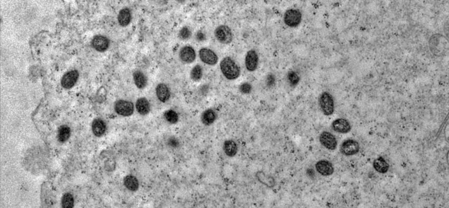 Brasil registra cerca de 1,5 mil casos de Mpox em 2024