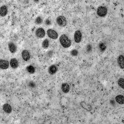 Brasil registra cerca de 1,5 mil casos de Mpox em 2024