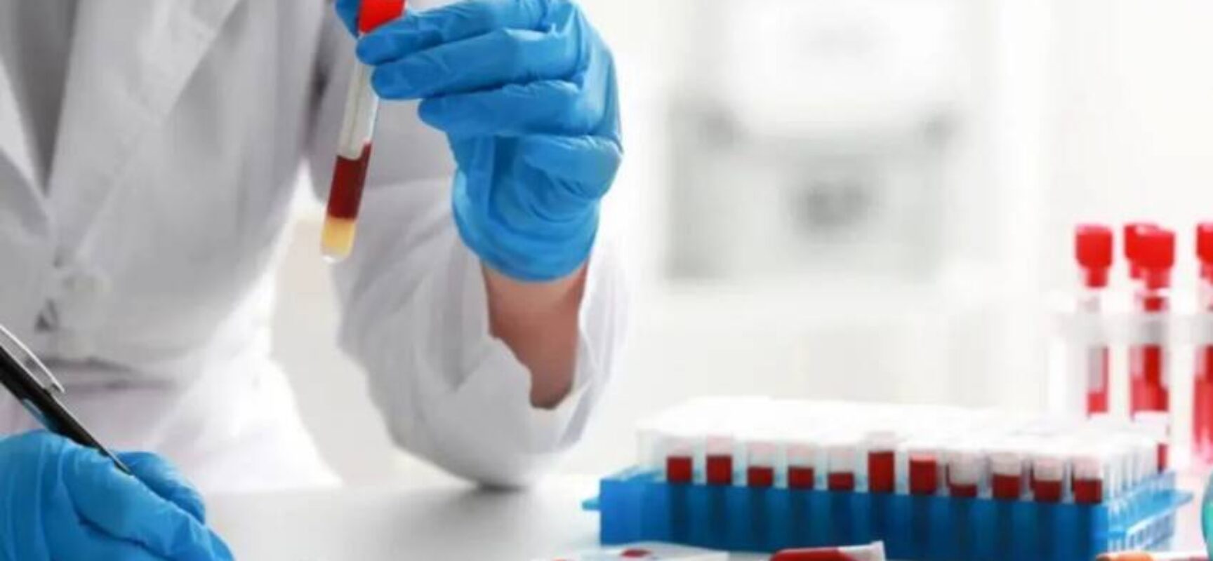 Reino Unido testa sangue artificial pela primeira vez em humanos