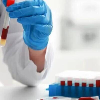 Reino Unido testa sangue artificial pela primeira vez em humanos