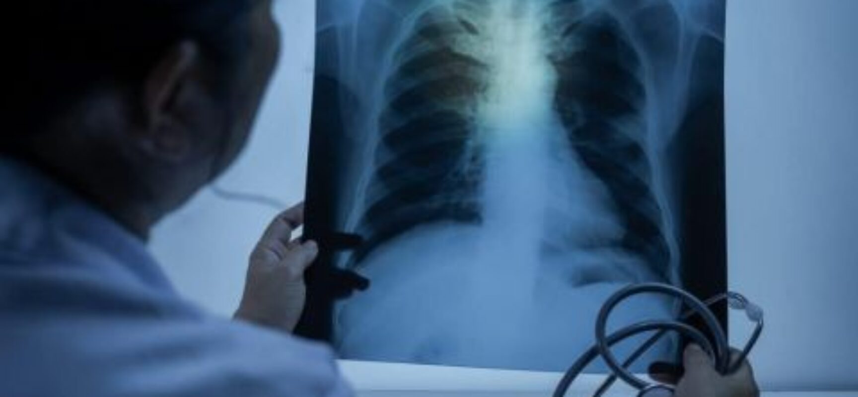 Lei institui campanha para conscientização sobre câncer de pulmão