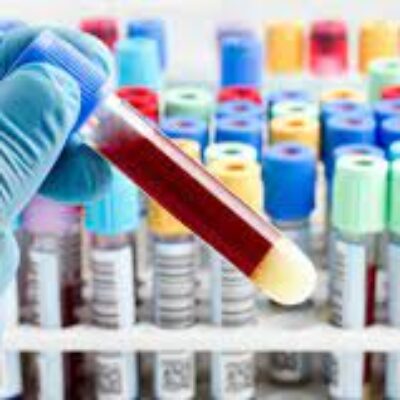 Prefeitura de Ilhéus amplia coleta de exames laboratoriais nas unidades de saúde