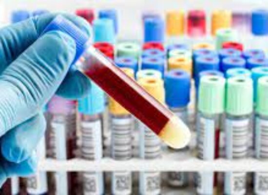 Prefeitura de Ilhéus amplia coleta de exames laboratoriais nas unidades de saúde