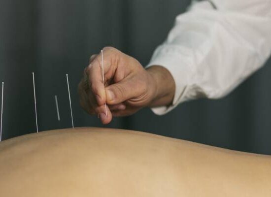 Governo federal regulamenta atuação profissional da acupuntura no Brasil