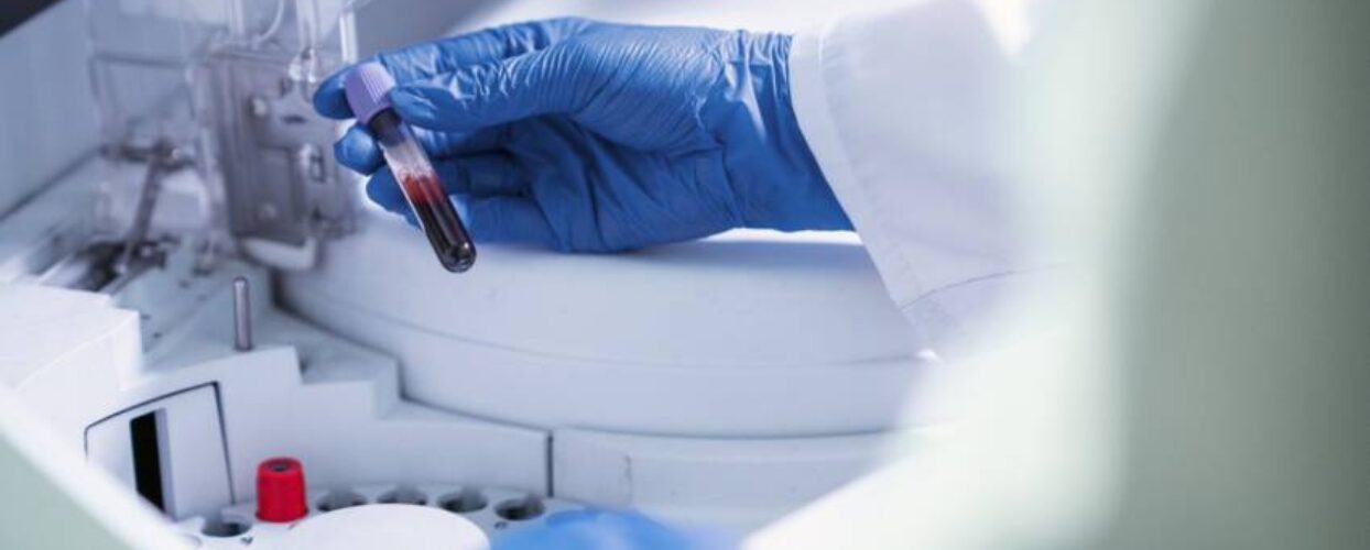 Exame de sangue para detectar Alzheimer chega ao Brasil