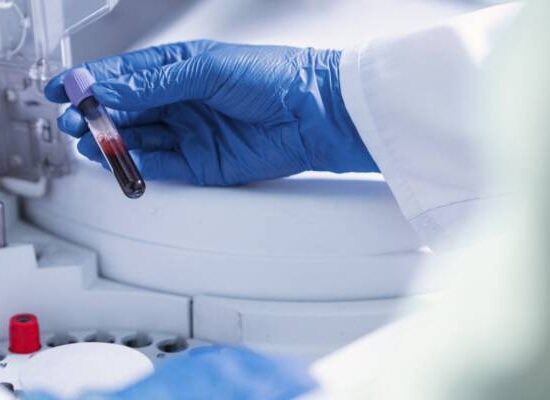 Exame de sangue para detectar Alzheimer chega ao Brasil